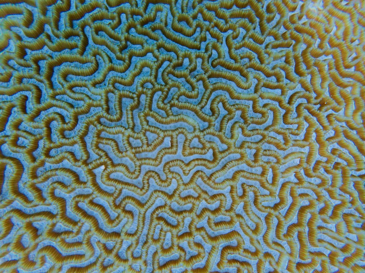 My endometriosis surgery&nbsp;story